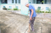 MCNV hỗ trợ người khuyết tật tiếp cận chân tay giả
